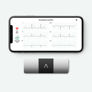 AliveCor KardiaMobile ECG 6L